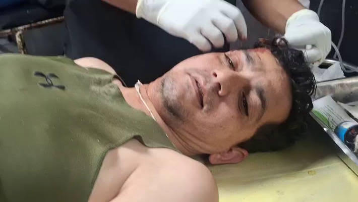 JK Police SI Hurt in Assault by Goons Near Bakshi Nagar Police Station