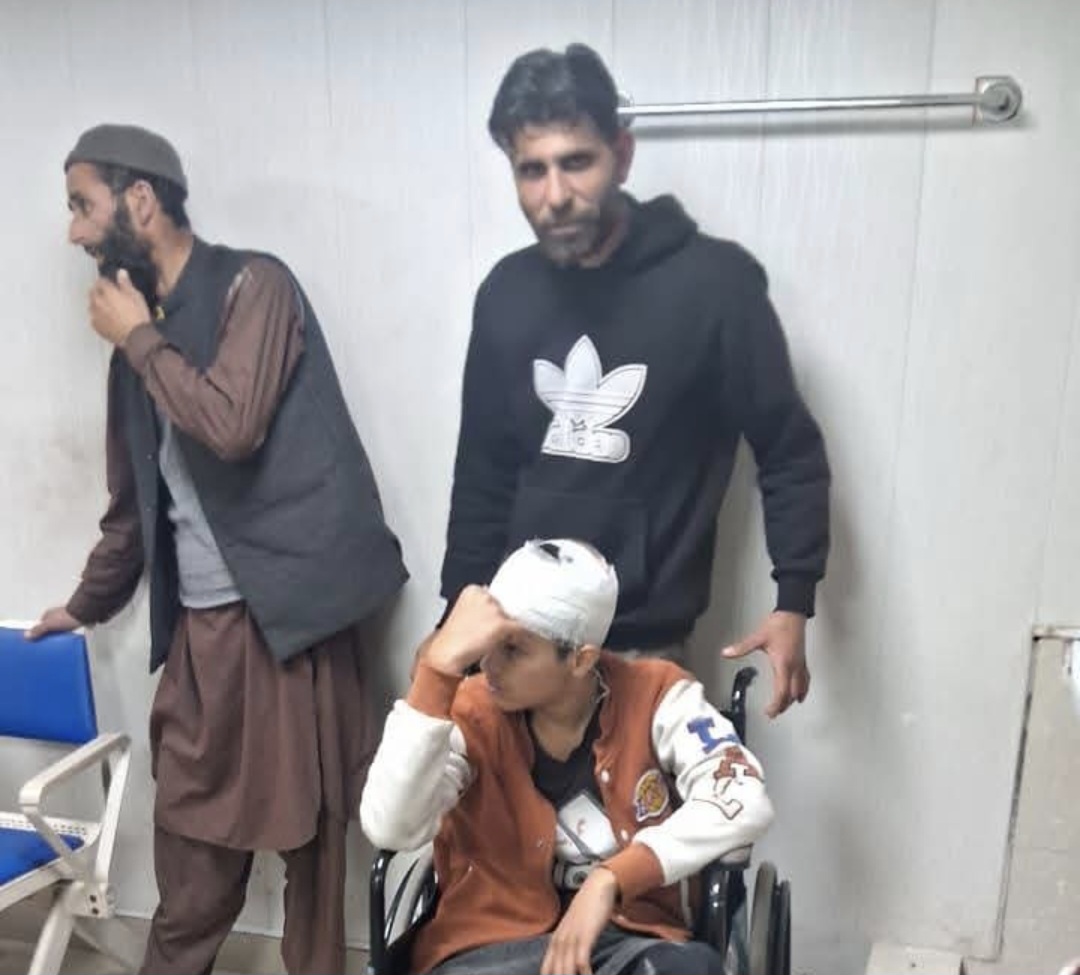 Young Kashmiri shawl seller suffers fractures, head injuries after mob attack in Uttarakhand